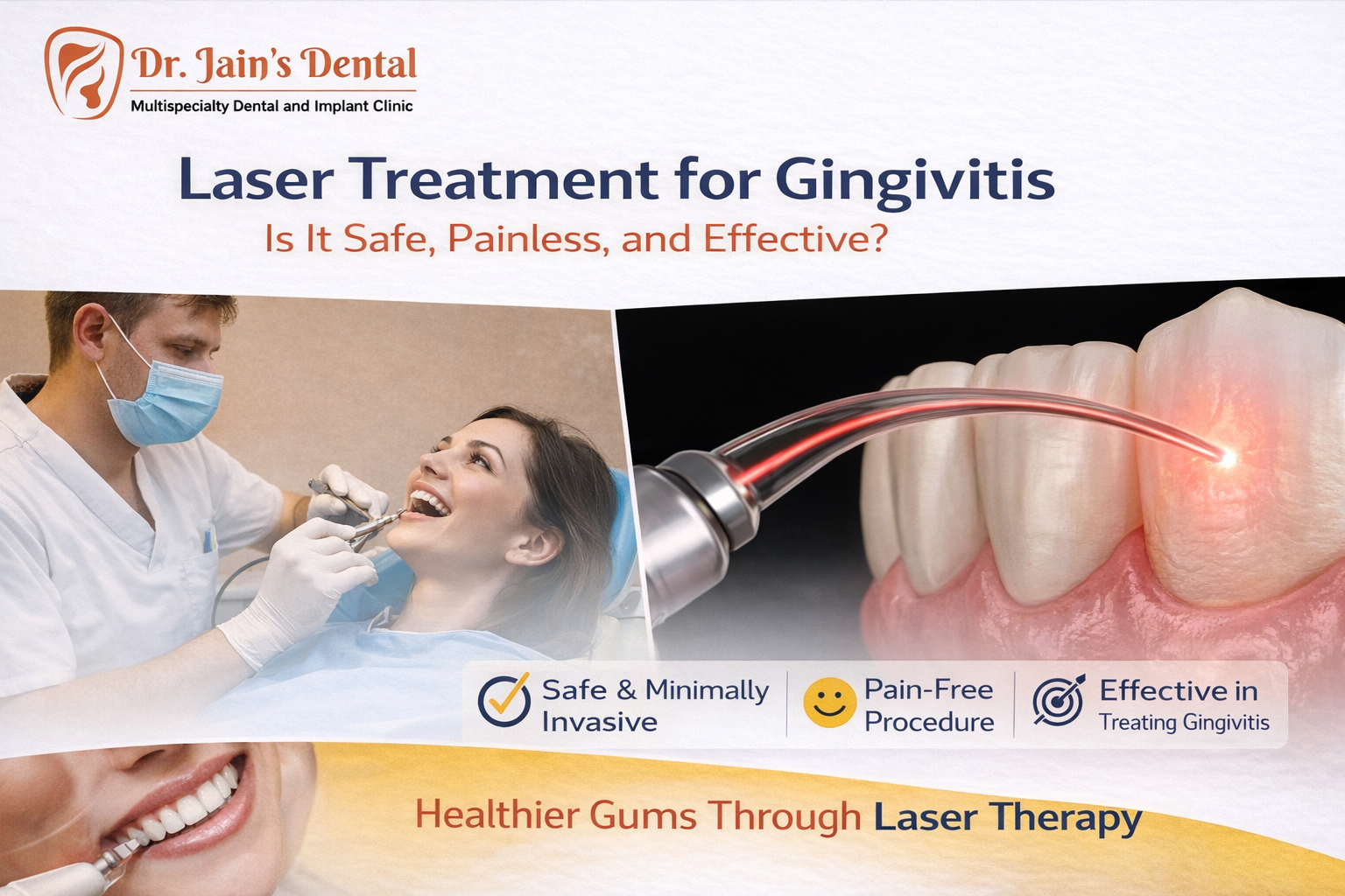 Laser Treatment for Gingivitis: Is It Safe, Painless, and Effective?